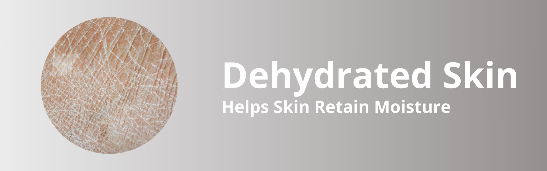 Dehydrated Skin